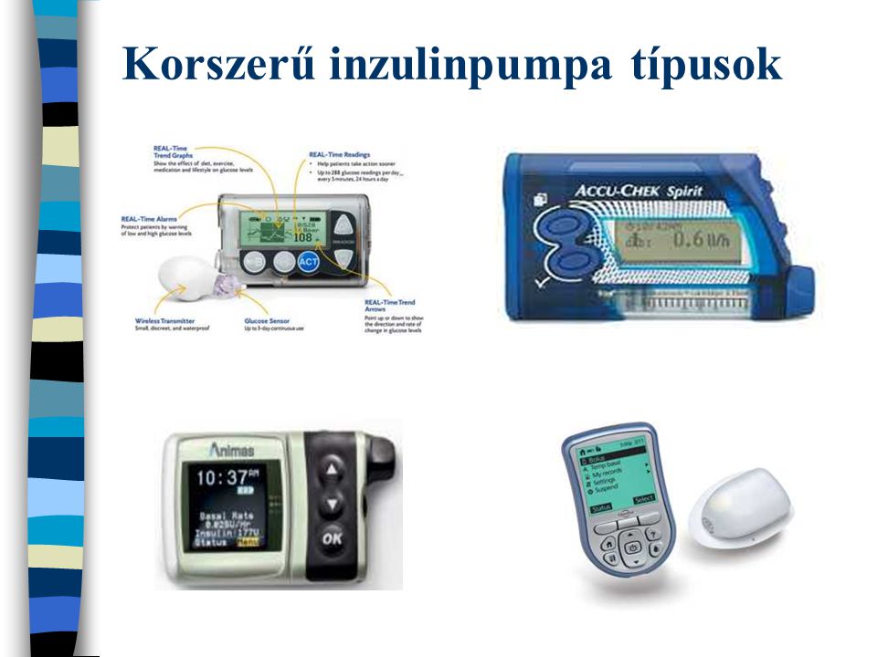 Szubkut n inzulinpumpa kezel s gyermekkori 1 es t pus diabetes